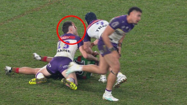 Lachlan Hubner was fined $1800 for an eye gouge on Trent Loiero.